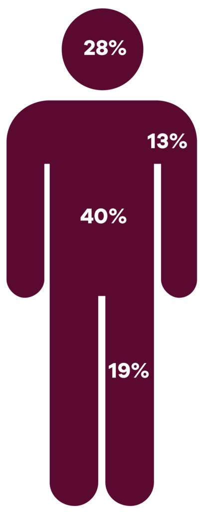 Diagram of statistical distribution of basal cell carcinoma (BCC) on the body