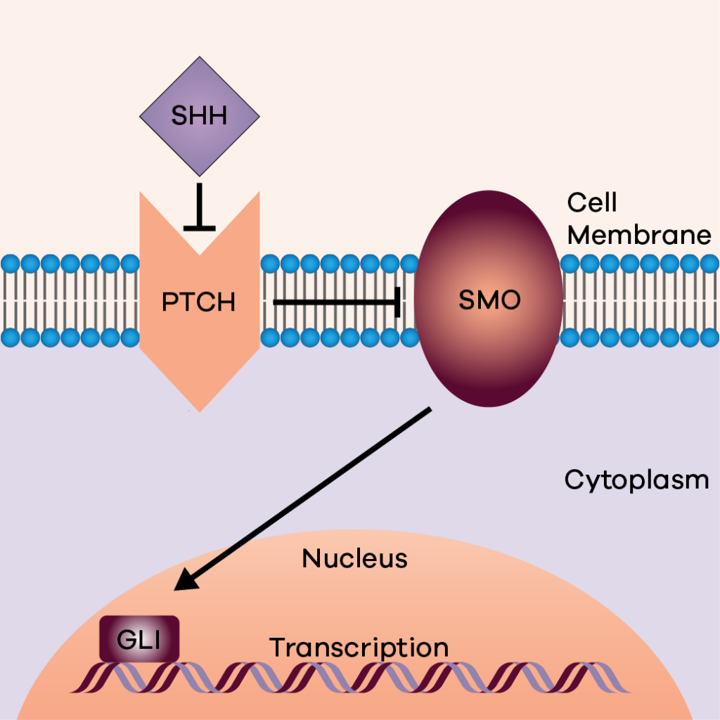 Sonic hedgehog pathway in BCC development